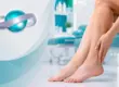 Отёк щиколоток и лодыжек при заболеваниях вен