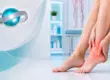 Боли в стопах и нижних конечностях — консультация флеболога